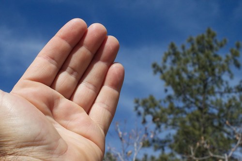 A close-up of an open hand against a blue sky and green tree background.