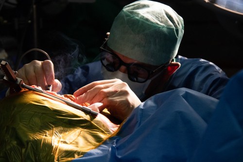 A surgeon in scrubs and goggles performs a procedure on a patient under bright surgical lights.