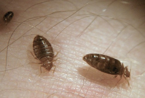 Close-up of two bed bugs on human skin, with fine hair visible around them.