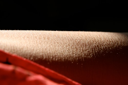 Close-up of skin with goosebumps, illuminated softly against a dark background.