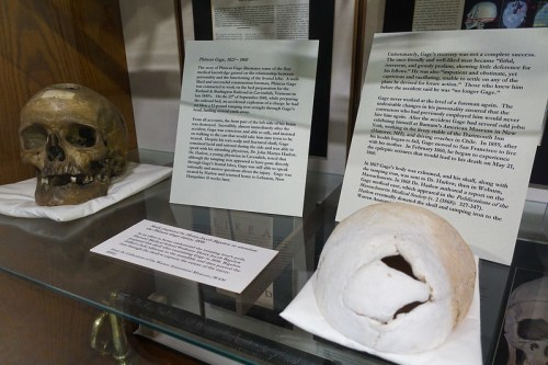 A display case featuring a human skull and two informational plaques about the individual and their historical context.