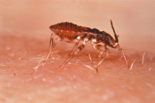 Close-up of a bed bug crawling on skin, showcasing its segmented body and long legs against a light background.