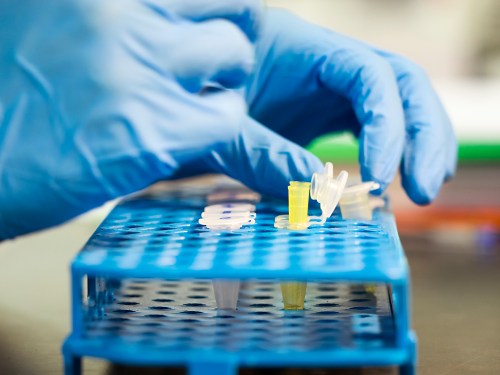 A gloved hand places a small yellow tube into a blue rack with various lab containers.