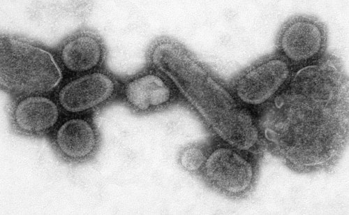 Microscopic view of viral particles, showcasing various shapes and sizes in a grayscale image.