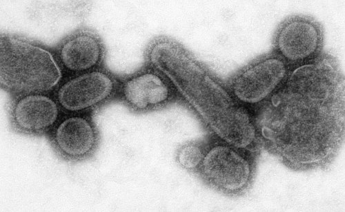 Microscopic view of viral particles, showing various shapes and sizes, in a grayscale image.