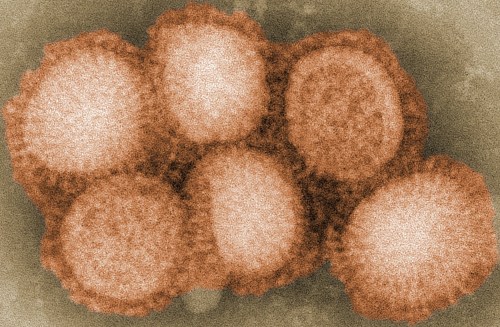 Microscopic view of several spherical virus particles clustered together, with a textured background.