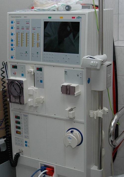 A medical dialysis machine with various controls, a monitor, and tubing, set up in a clinical environment.