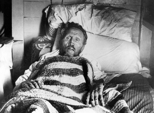 A man lying in bed, looking frail and unwell, surrounded by blankets in a dimly lit room.