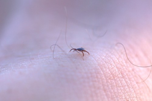 A close-up of a small tick on human skin, highlighting its legs and texture against the skin's surface.