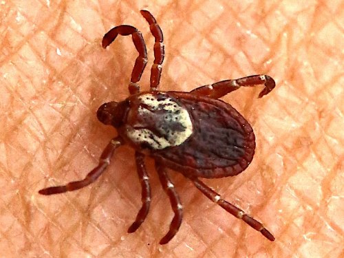 Close-up of a tick on human skin, showing its brown body and distinctive markings.
