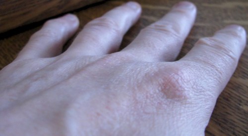 A close-up of a human hand resting on a wooden surface, showing skin texture and details of the fingers.