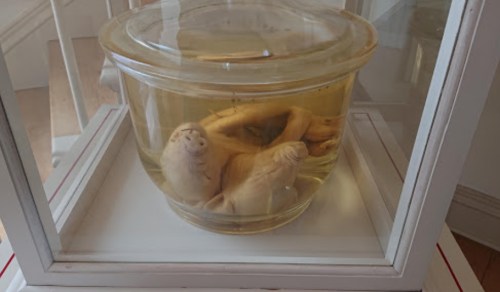 A glass jar containing preserved specimens in yellowish liquid, displayed in a showcase.