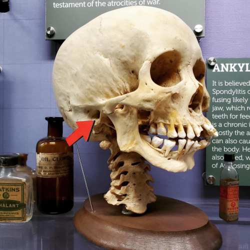 A human skull model displayed with an arrow pointing to a specific area, alongside vintage bottles in a museum setting.