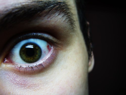 Close-up of a human eye with a green iris and visible blood vessels, set against a dark background.