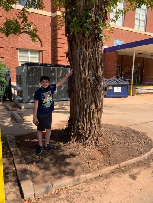 A child stands next to a large tree, touching its textured bark, with a building and dumpster in the background.