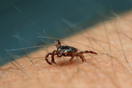 Close-up of a tick crawling on human skin, surrounded by fine hair.