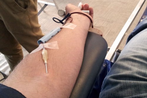 A close-up of a person's arm with a needle inserted for blood donation, showing adhesive bandages and a blood bag.