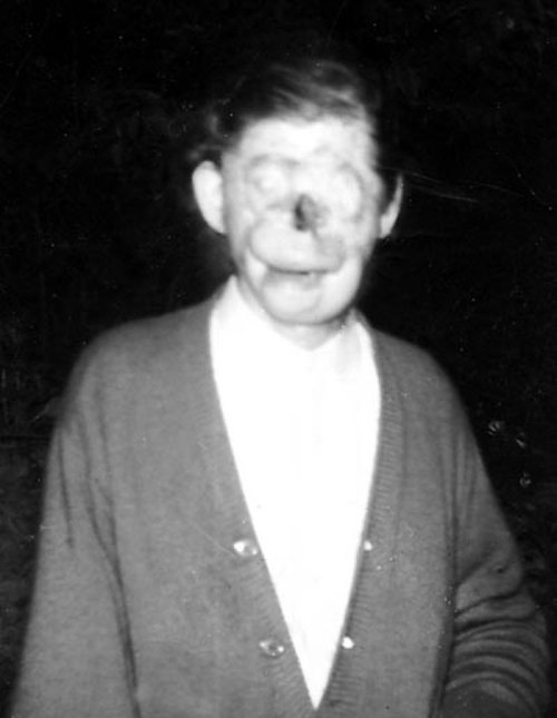 A blurred black-and-white photo of a person with an unusual facial appearance, wearing a cardigan.