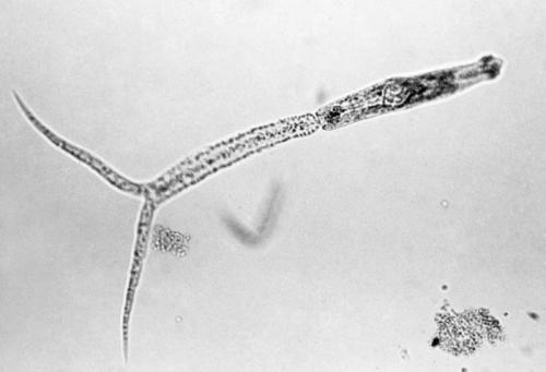 Microscopic image of a slender, elongated organism with a tapered end, set against a light background.
