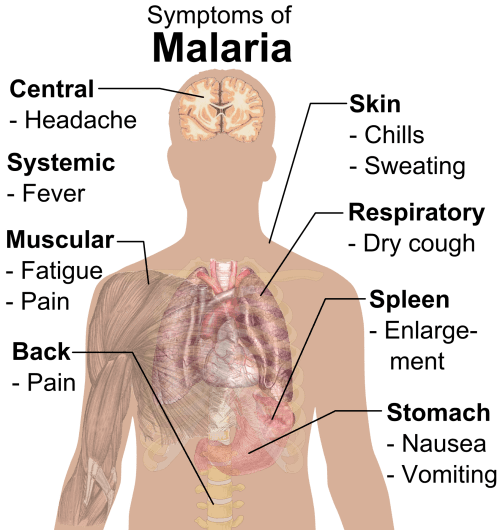 Illustration of a human body highlighting malaria symptoms: headache, fever, chills, cough, fatigue, and nausea.