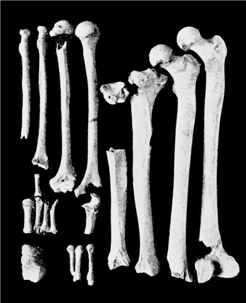 A collection of various human bones arranged on a black background, showcasing different sizes and shapes.