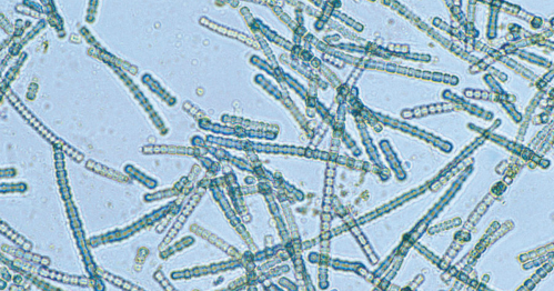 Microscopic view of blue-green algae, showing elongated, filamentous structures in a light background.