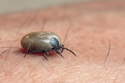 A close-up of a tick on human skin, showcasing its round body and legs against the hair and skin texture.