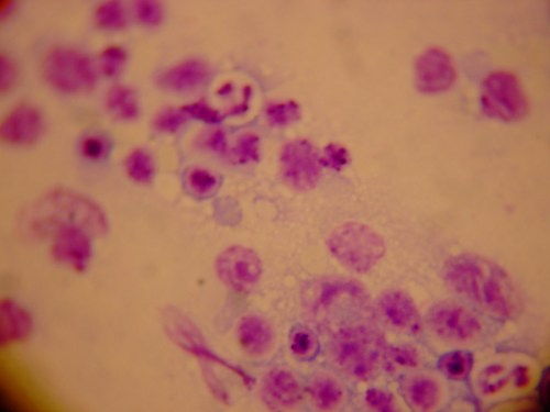 Microscopic view of purple-stained cells on a light background, showing various cell shapes and sizes.