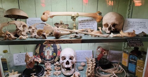 A collection of human bones from the Anatomy of Death Museum in Michigan.